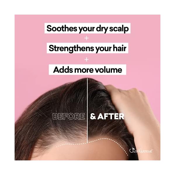 Grow-New-Hair-Treatment-Hair-Regrowth-Oil-Natural-Hair-Care-Hair-Growth-Treatment-For-Men-and-Women-Just-Nutritive-4-Oz Grow New Hair Treatment | Hair Regrowth Oil | Natural Hair Care | Hair Growth Treatment For Men and Women | Just Nutritive | 4 Oz