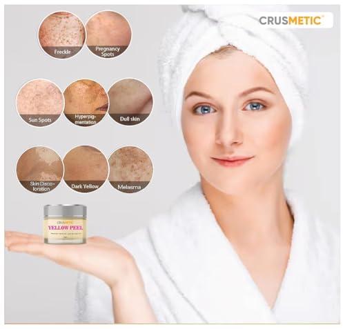 Image of Exfoliating Retinol Yellow peel| Improve Skin Texture | Removes Dead Skin Layer | Improves Skin Colour Tone| Fades Dark Spots| Men & Women| (15gm)