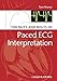 The Nuts and bolts of Paced ECG Interpretation