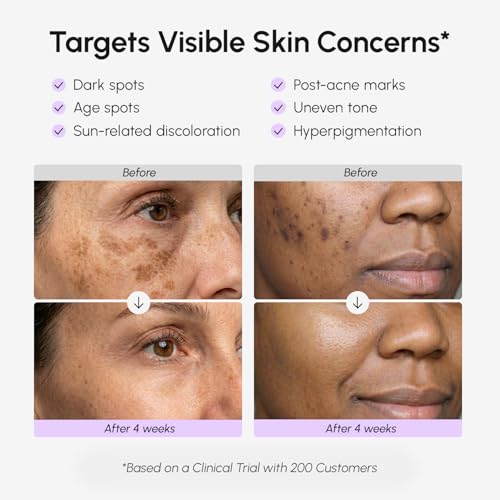 MAREE Dark Spot Remover for Face and Body – Dark Spot Corrector Serum – Hyperpigmentation, Melasma, Sun & Age Spots – Black & Brown Spot Remover for Women – Crema para Manchas Oscuras en la Cara - Image 4