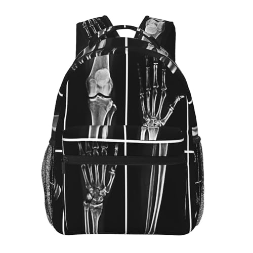 X Ray Skull Radiology Backpack for Men Women, Travel Laptop Backpack Computer Bag Daypack for Business Work Weekender