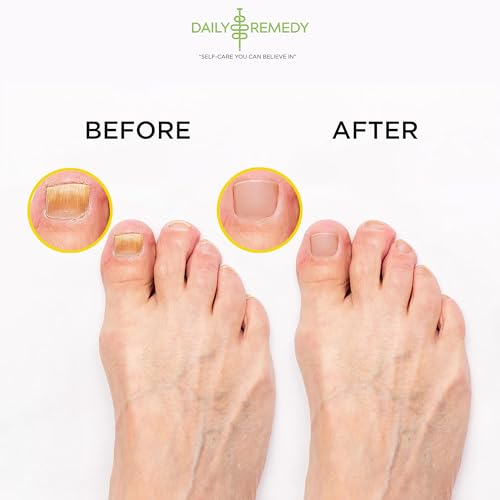 image for DAILY REMEDY Citrus Detox Foot Soak with Epsom Salt - Pack of 2 - Remo