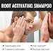 2pcs,Root Activator Shampoo,Hair Regrowth, Unisex, Natural Formula for Men and Women,Smooth Strong Repair Conditioning Shampoo