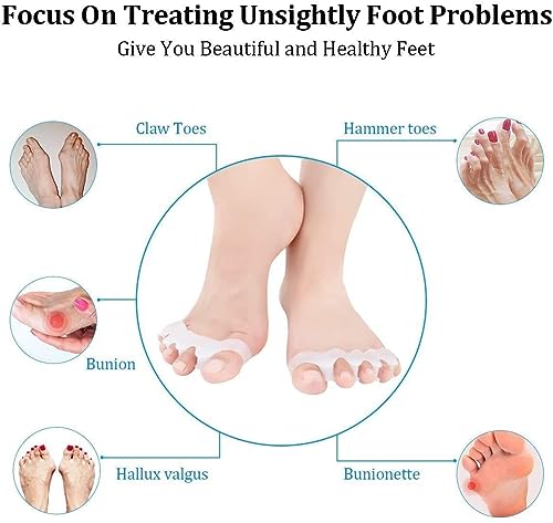 Image of Toe Separator for Feet Toe Spacers Correct Toes Yoga Silicone Hammer Toe Corrector for Women & Men Correct Toe Straighteners for Overlapping Toes (All Finger Toe Separator)