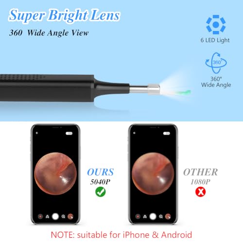 ACWOO Ear Otoscopes, 5040P HD Wireless Ear Wax Removal Kit with Camera, Visual Ear Otoscope Ear Cleaner with 6 LED Lights - Image 3