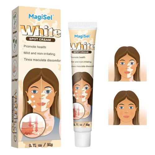 Crema Manchas Blancas, Crema de Vitiligo, Cremas calmante para el vitíligo, Reduce las manchas blancas de forma suave y eficaz, Mejora la pigmentación, Apta para todo tipo de piel 20G