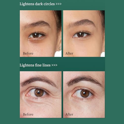 Creme de olhos Retinol para olheiras e bolsas sob os olhos, creme hidratante antienvelhecimento para