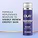 Olay Treatment Cream Intensive Crepey Skin Correcting for Neck & Chest with Retinol24, Vitamin B3 Complex, Deeply Hydrates, Renews & Smoothes Skin, 1.7 fl oz
