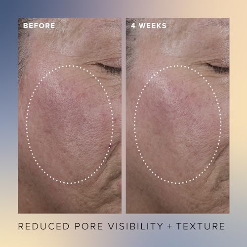 Farmacy Face Exfoliator Serum - Honey Glow 17% AHA + BHA Liquid Exfoliant & Salicylic Acid Serum - Resurfacing Skin Care for Reduced Pores + Texture - Hydrates Skin for an Overall Glow (30ml)