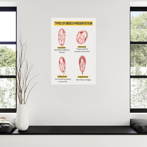 Guide position fœtale affiche éducation prénatale poster présentation siège anatomie - 4