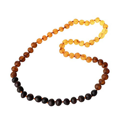 Baltic Amber Necklace - Adult Raw Amber Bead Necklace - Rainbow Pattern Unpolished Amber Beads - Multiple Lengths (21.7)