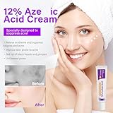 12% Acid Spot Cream - Acne Treatment - Acne Cream for Spot Prone Skin - Anti, Rosacea for Face,Pimple Crea-m,Dark Spo-t Remover - Pimple cream Face Moisturiser - Even Skin Tone - Image 2