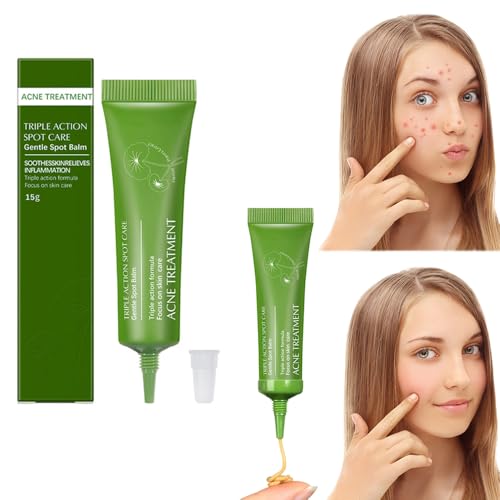 Azonee Acne Cream, Anti-Acne Face Cream with Centella, Spot Treatment ...
