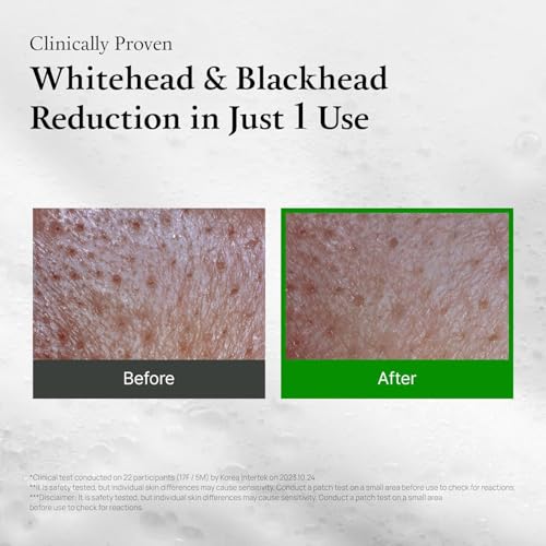 FULLY Green Tomato Pore Cleanser, Cardi B’s Clay Mask Cleanser for Deep Pore Cleanse & Pore Minimizer, Blackhead & Sebum Control, Gentle Face Wash for Women, Korean Skincare - Image 5