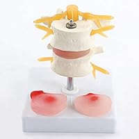 Algopix Similar Product 20 - TwoSection Lumbar Vertebrae Disease