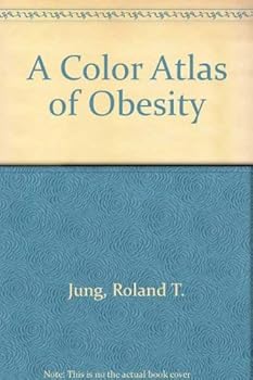 Hardcover A Color Atlas of Obesity Book