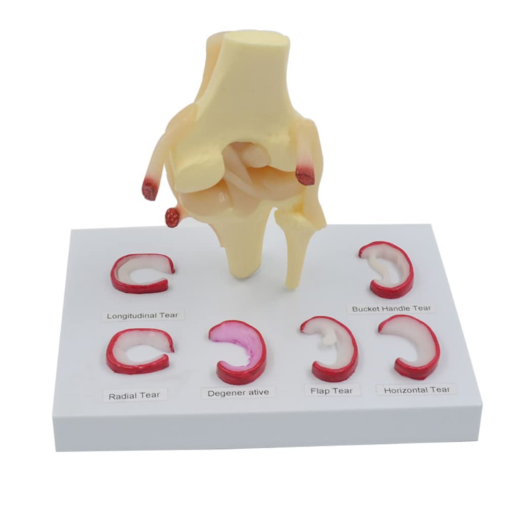 Modelo de sutura de menisco modelo anatómico de instrumentos de enseñanza médica de menisco humano de tamaño real