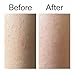 The INKEY List Glycolic Acid Exfoliating Body Stick - Deep Exfoliation for Rough, Bumpy Skin, Fragrance Free, Targets KP & Ingrown Hairs, Suitable For All Skin Types