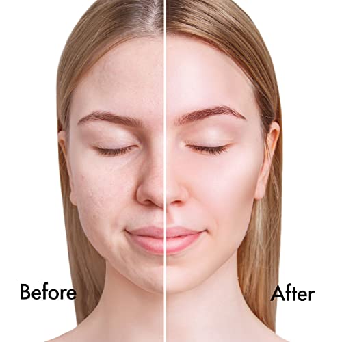 Sorme Cosmetics Believable Finish Powder Foundation In Honey Dusk | Medium To Full Coverage Foundation Powder Makeup | Matte Finish Pressed Powder | Rejuvenating Face Powder #TOP2