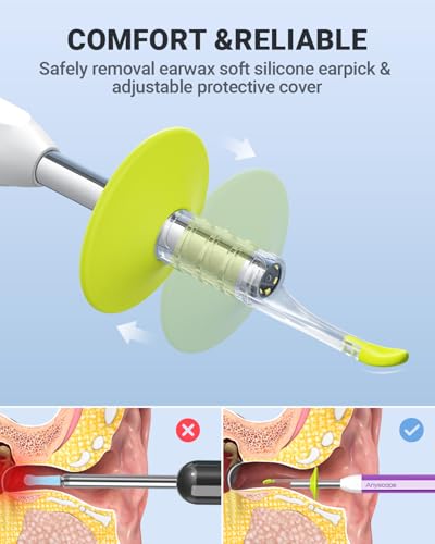 AnyScope デジタルオトスコープ ジャイロスコープ付き HDイヤーカメラ イヤーワックス除去ツール付き ビデオイヤースコープ ライト付きオトスコープ iPhoneとAndroidに対応 (パープル)