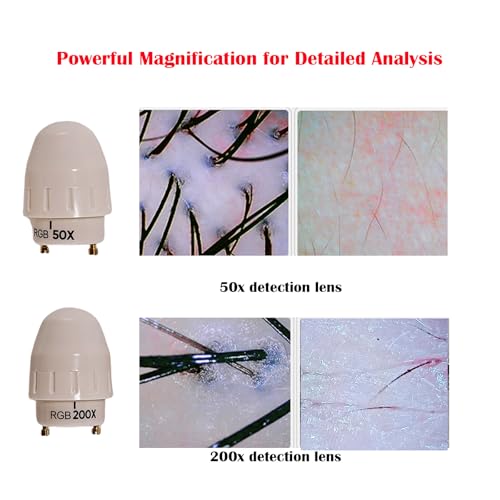 Professional Scalp Camera with 11-Inch HD Screen - High-Definition Hair & Scalp Analysis Device for Salons and Spas, Easy to Use, Ideal for Scalp Care & Client Consultations - Image 3