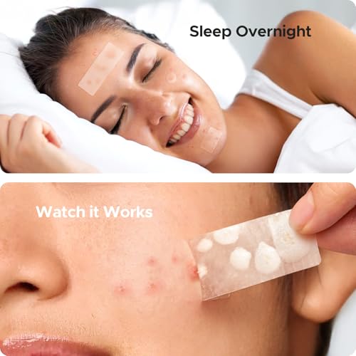 image for TKTK Large Pimple Patches for Face, 7 Sizes XL Acne Patches, Big Hydro