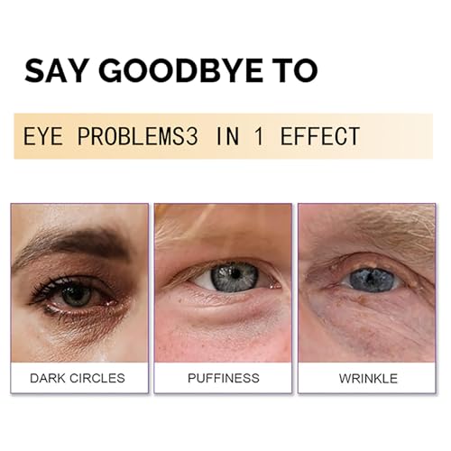 Easilydays Snail Peptide Advanced Under Eye Cream For Dark Circles thumb #4