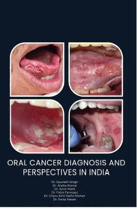 Buy Oral Cancer Diagnosis and Perspectives in India Book Online at Low ...
