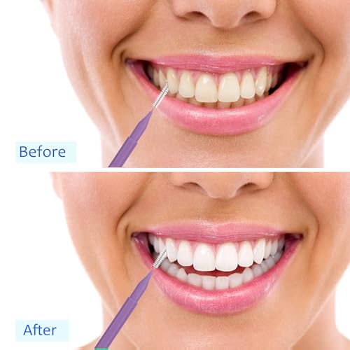 Image of Patelai 100 Pieces Braces Dental Brush for Cleaner Interdental Toothpick Dental Tooth Flossing Head Oral Hygiene Flosser Toothpick Cleaners Tooth Tool(Multicolor,Mixed Size)