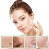 VGO 2% BHA Salicylic Acid Exfoliant Toner for Pore-Clarifying & Skin Renewal, 120ml / 4.06oz