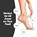 PedEgg Power Cordless Motorized Callus Remover w/ Bright LED Light As Seen On TV, Quickly Removes Calluses & Dry Skin w/ 2000 RPMs of Spinning Action for Smooth, Soft Feet, Easy-Grip Ergonomic Handle