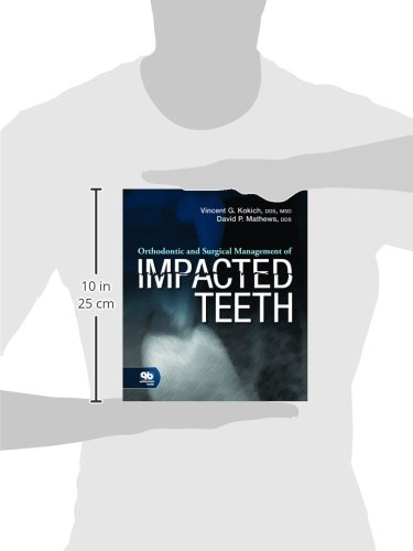 Orthodontic and Surgical Management of Impacted Teeth
