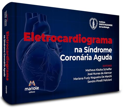 Eletrocardiograma na síndrome coronária aguda: