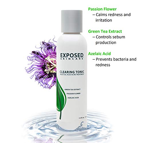 Basic Kit by Exposed Skin Care Acne Treatment System (60 Day supply) Heals and Prevents Teen