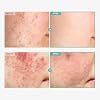 TOSOWOONG Dexpanthenol Cream, 170,000ppm B5 Panthenol, Madecassoside, Centella Asiatica for Skin Barrier Repair, Facial Moisturizer, Soothing, Hydrating, Korean Skincare, 60ml, 2.02 fl. oz.