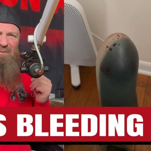 I Was BLEEDING Through My Prosthetic&hellip; Here&rsquo;s What Keto Did to My Body
