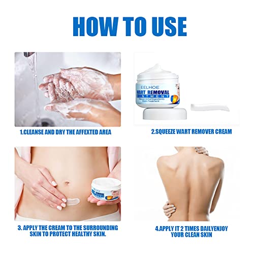 Skin Tag Removal Cream, Skin Tag Remover Freeze