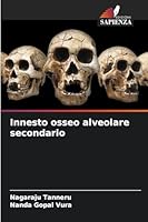 Innesto osseo alveolare secondario (Italian Edition) 6208724929 Book Cover