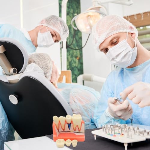 Modèle d'implant dentaire pour résoudre les erreurs d'analyse de pont - 4
