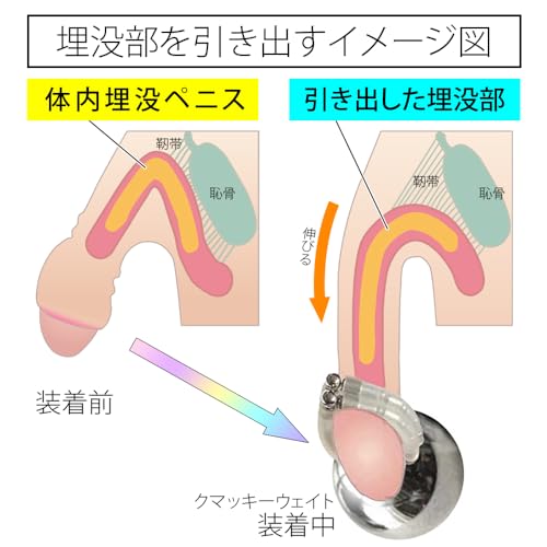 クマッキー ウェイト 300CR鎖型・多機能ペニスリング フリーサイズ 日本製 昼夜 兼用 チントレ ペニスストレッチ グッズ（亀頭露出器具として使用時の落下防止ストラップ無） - 画像4