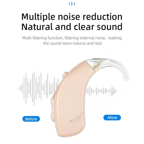 Image of Aika AK-6133 Digital Rechargeable Hearing Aid Machine - AI Technology 4 Channel BTE with Active Noise Cancellation, USB Recharge, Maximum Output 129dB (Beige, with Dry Kit and 1 Year Warranty)