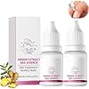 Fungigone Fungal Nail Treatment,Ginger Nail Essence, Natural Nail Strengthener, Nail for Toenail and Fingernail, Restoring Healthy Nails