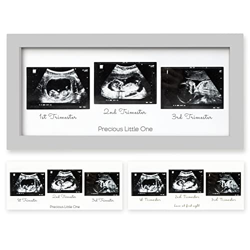 Image of Sonogram Picture Frame - Trio Ultrasound Picture Frames For Mom To Be Gift - Baby Ultrasound frame - Pregnancy Announcements Sonogram frame - Baby Nursery Decor, Pregnant Mom Gifts (Cloud Gray)