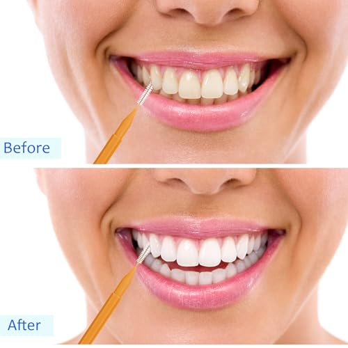 Image of Patelai 100 Pieces Braces Dental Brush for Cleaner Interdental Toothpick Dental Tooth Flossing Head Oral Hygiene Flosser Toothpick Cleaners Tooth Tool(Green,Orange,Mixed Size)