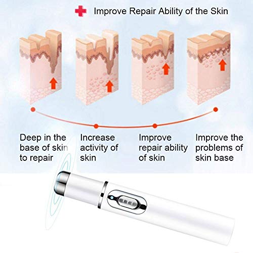 MZNTBW Blue Light Therapy Vene Varicose Penna