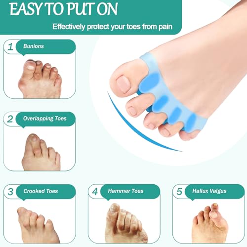 Heartfeltyire Espaçadores de dedos para pedicure, mulheres, 4 peças, gel de silicone, joanetes, dor