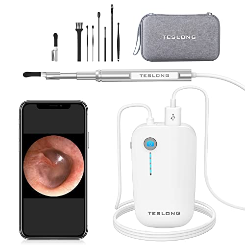 Best Otoscope for Home Use
