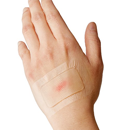 Curad Soothe & Cool Burn Bandages, Instant Cooling Relief, 1.8" X 2.96", 8 Count #TOP4