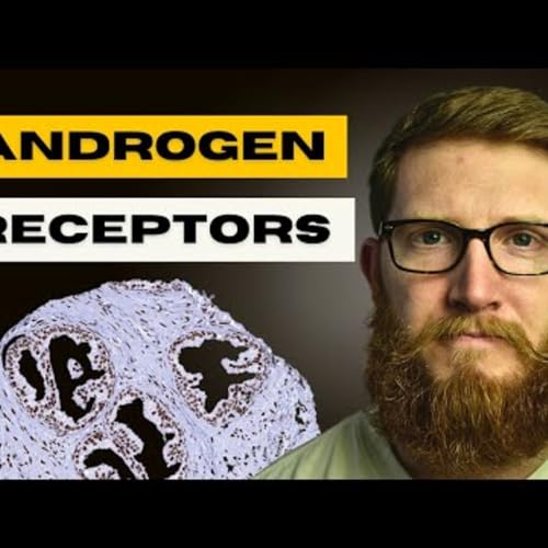 Androgen Receptors | How To Increase Your Response To Testosterone