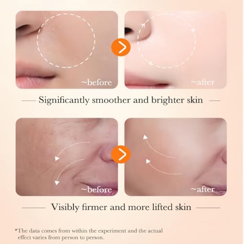 Image of Dark Spot Corrector With Anti-Aging Melasyl + 30% AHA REJUVENATING, Discoloration Correcting Serum for Sun Spots, Age Spots & Post-Acne Marks Korean Skincare | 1.01 fl.oz. (AHA REJUVENATING)